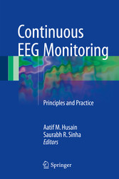 Continuous EEG Monitoring