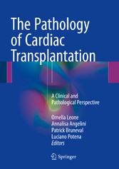 The Pathology of Cardiac Transplantation