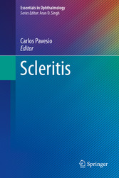 Scleritis