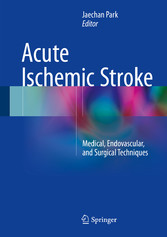 Acute Ischemic Stroke