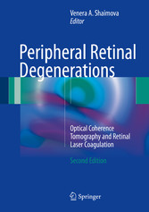 Peripheral Retinal Degenerations