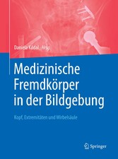 Medizinische Fremdkörper in der Bildgebung