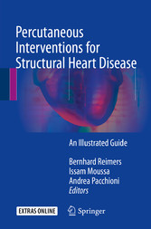 Percutaneous Interventions for Structural Heart Disease