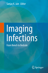 Imaging Infections