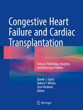 Congestive Heart Failure and Cardiac Transplantation