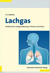 Lachgas