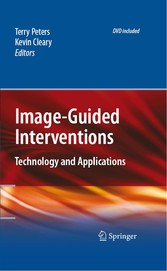 Image-Guided Interventions