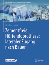 Zementfreie Hüftendoprothese: lateraler Zugang nach Bauer