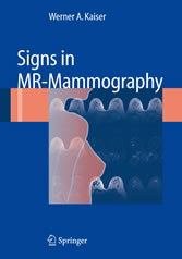 Signs in MR-Mammography