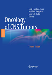 Oncology of CNS Tumors