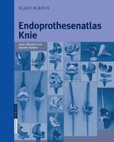 Endoprothesenatlas Knie