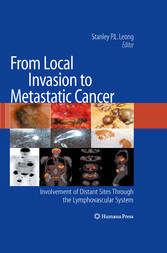 From Local Invasion to Metastatic Cancer