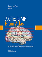 7.0 Tesla MRI Brain Atlas