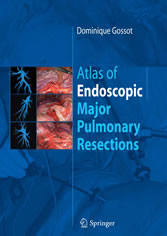 Atlas of endoscopic major pulmonary resections