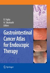 Gastrointestinal Cancer Atlas for Endoscopic Therapy