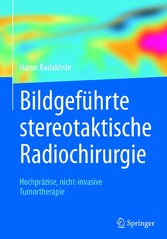 Bildgeführte stereotaktische Radiochirurgie