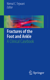 Fractures of the Foot and Ankle