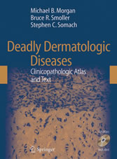 Deadly Dermatologic Diseases