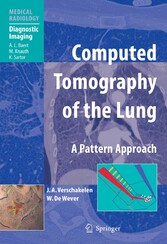 Computed Tomography of the Lung