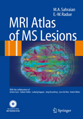 MRI Atlas of MS Lesions