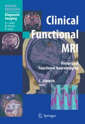 Clinical Functional MRI