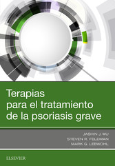 Terapias para el tratamiento de la psoriasis grave