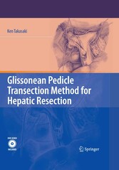 Glissonean Pedicle Transection Method for Hepatic Resection