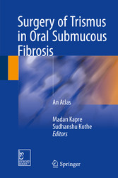 Surgery of Trismus in Oral Submucous Fibrosis