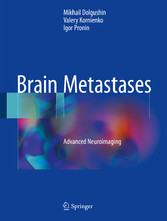 Brain Metastases