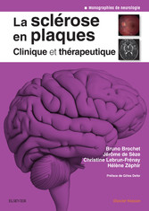 La sclérose en plaques - Clinique et thérapeutique