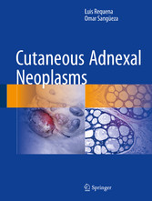 Cutaneous Adnexal Neoplasms