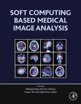 Soft Computing Based Medical Image Analysis