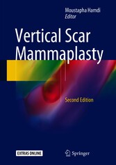 Vertical Scar Mammaplasty