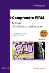 Comprendre l'IRM