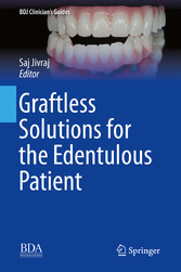 Graftless Solutions for the Edentulous Patient