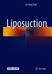 Liposuction