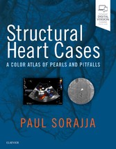 Structural Heart Cases E-Book