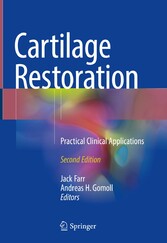 Cartilage Restoration