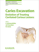 Caries Excavation: Evolution of Treating Cavitated Carious Lesions