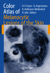 Color Atlas of Melanocytic Lesions of the Skin