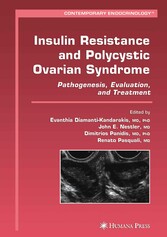 Insulin Resistance and Polycystic Ovarian Syndrome