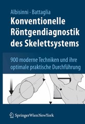 Konventionelle Röntgendiagnostik des Skelettsystems