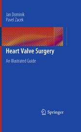 Heart Valve Surgery