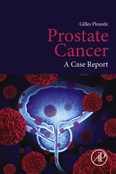 Prostate Cancer