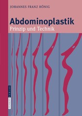 Abdominoplastik