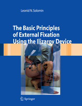 The Basic Principles of External Skeletal Fixation Using the Ilizarov Device