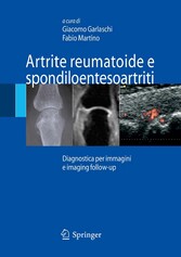 Artrite reumatoide e spondiloentesoartriti