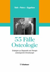 55 Fälle Osteologie