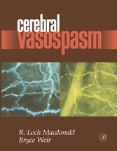 Cerebral Vasospasm