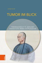 Tumor im Blick